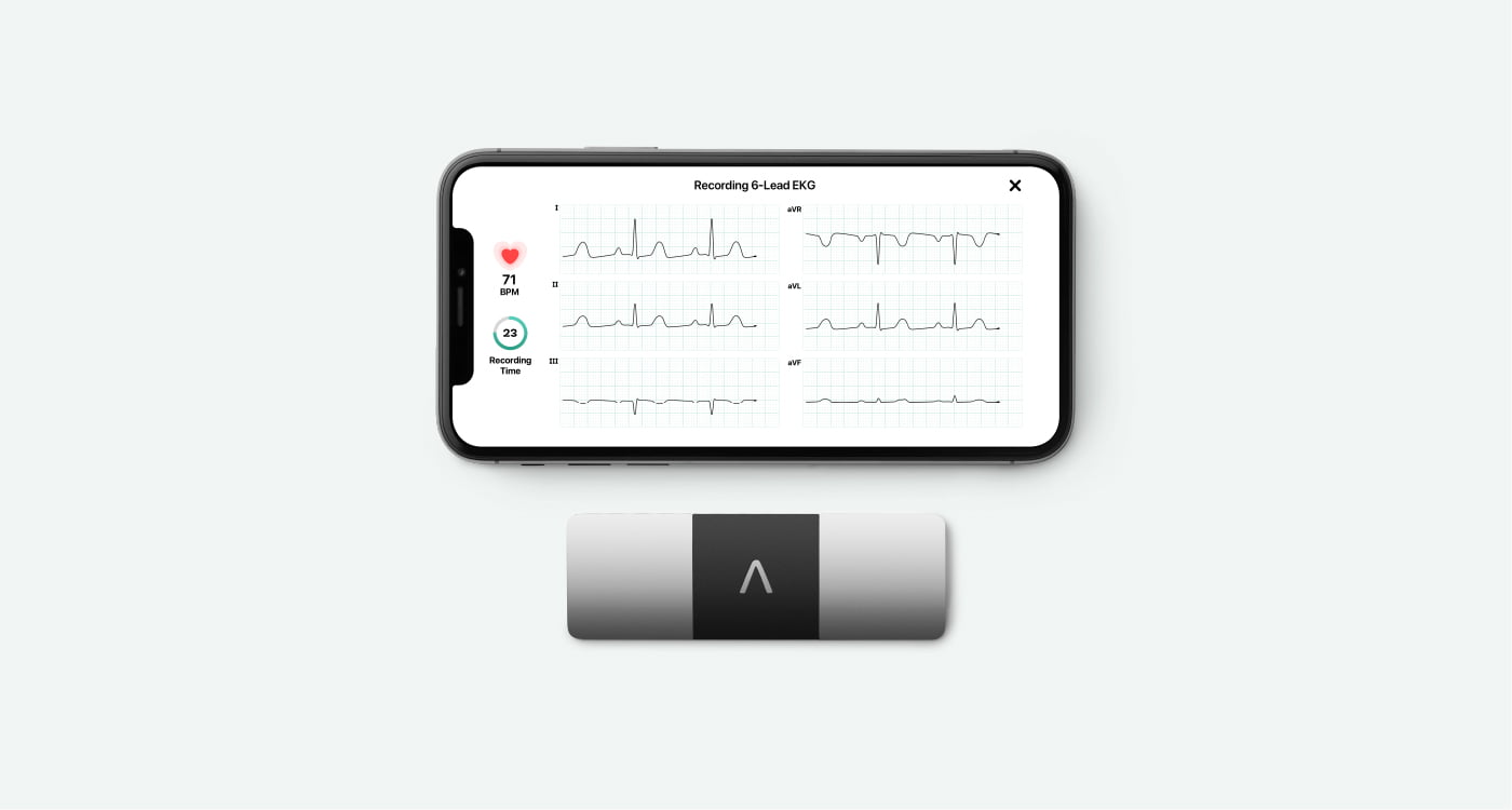 6-lead EKG being taken with KardiaMobile 6L